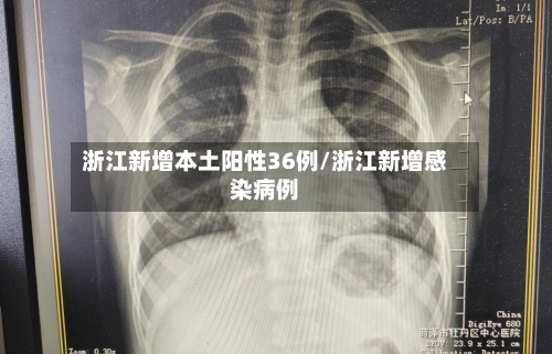浙江新增本土阳性36例/浙江新增感染病例