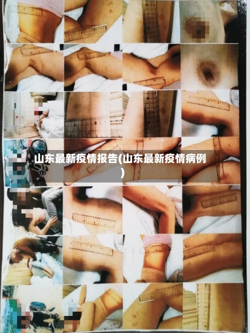 山东最新疫情报告(山东最新疫情病例)-第3张图片
