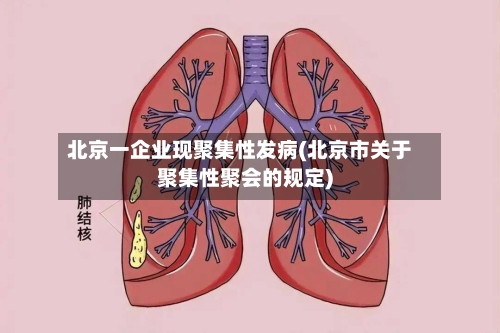 北京一企业现聚集性发病(北京市关于聚集性聚会的规定)-第2张图片