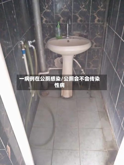 一病例在公厕感染/公厕会不会传染性病