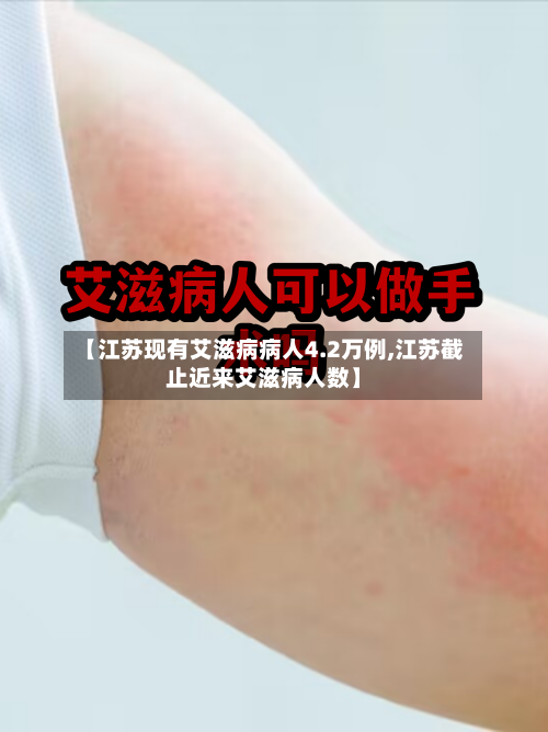 【江苏现有艾滋病病人4.2万例,江苏截止近来艾滋病人数】-第2张图片